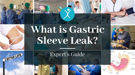 How to Detect Common Gastric Sleeve Leak。